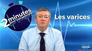 Les varices - 2 minutes pour comprendre