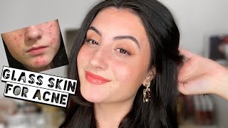 NATURAL GLASS SKIN MAKEUP FOR ACNE | No Foundation, Minimal Makeup screenshot 5