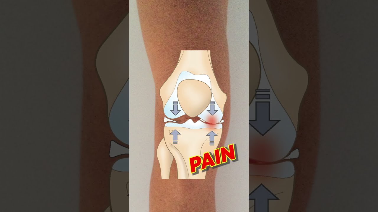What Is Meniscus 