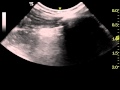 canine ultrasonography: pneumothorax with loss of 