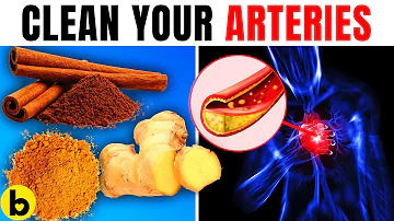 13 Powerful Spices You Should Eat To Unclog Arteries And Prevent A Heart Attack