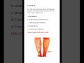 Medicine & Surgery MCQs (For MBBS, USMLE, MCCQE & PLAB)