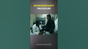 Rotationplasty Procedure 3D animation #madical #world #haelth #growth #yt #video #ytshorts