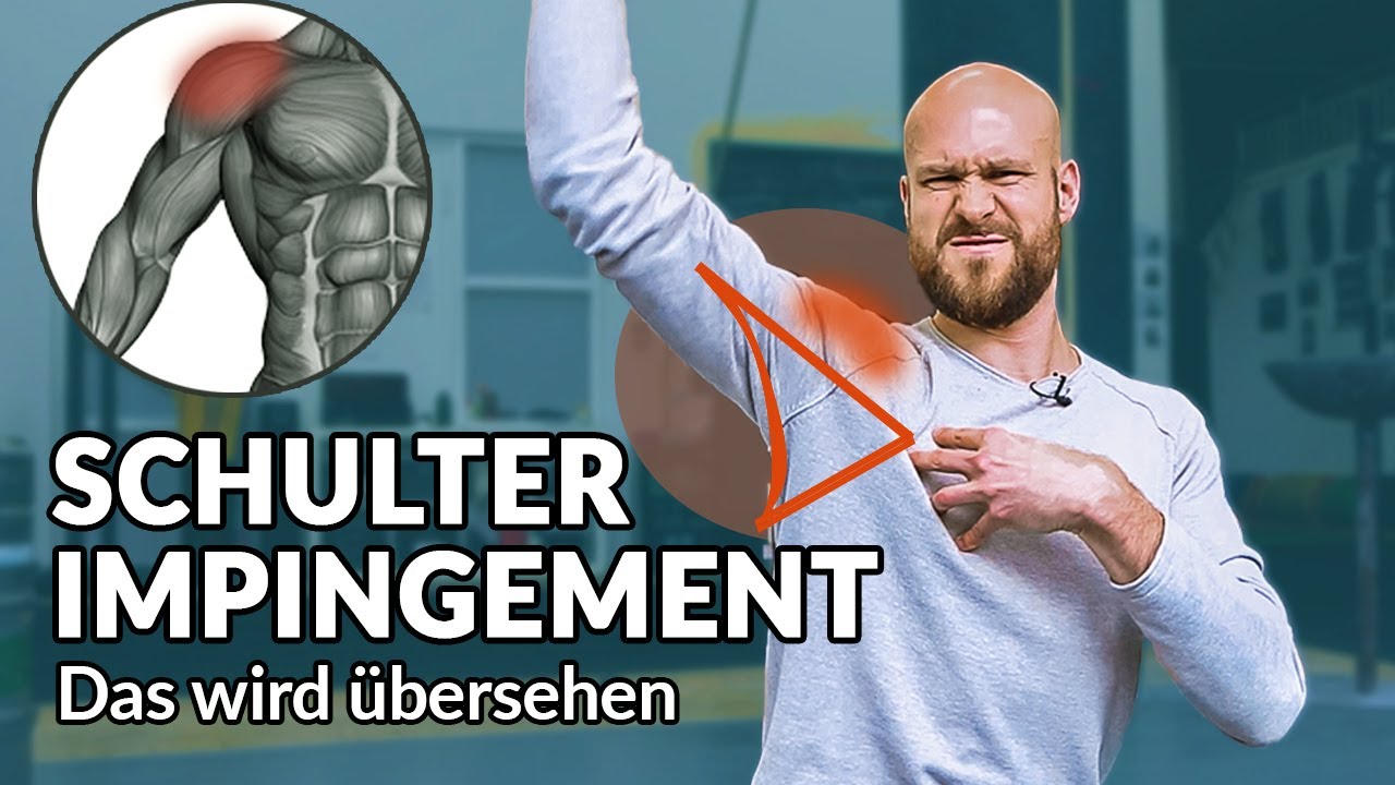 Schulter Impingement lösen - Mache diesen Fehler nicht und befreie dich (+Übung)