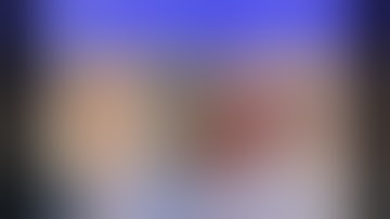 HOW TO DO the RETROMANDIBULAR APPROACH & DISSECTION