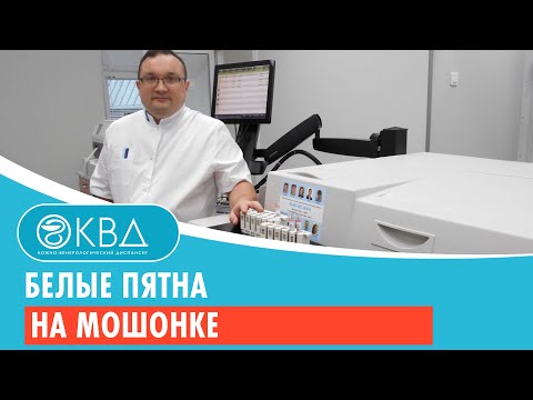 Белые пятна на мошонке. Клинический случай №129