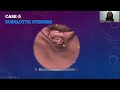 Dr Mayuri Jugulkar | CT bronchoscopy || #mriteachingcourse