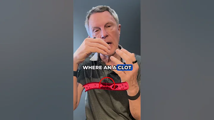 Why Aspirin Cleans Arteries