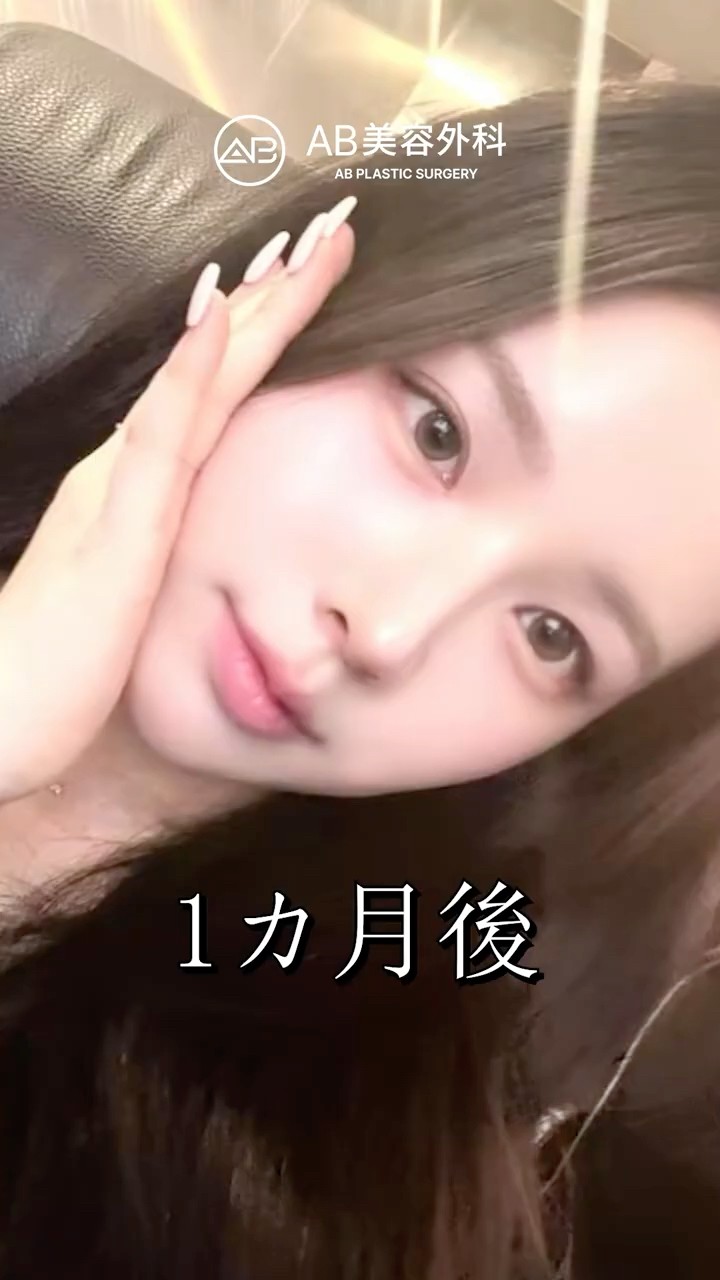 整形なのに自然すぎて気づかないレベル。 #shorts