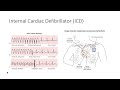 EKG Video 10 0