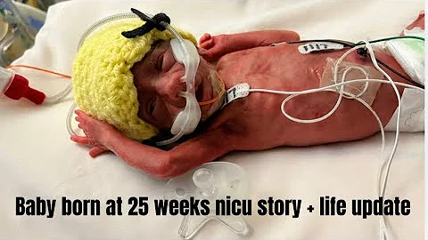 Our nicu journey after having a baby at 25 weeks + life after the nicu update // premature baby
