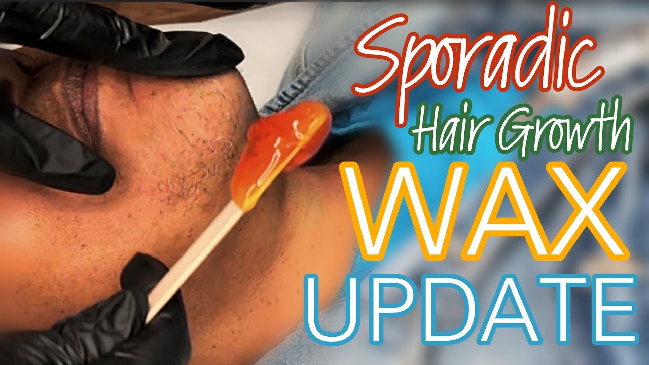 Waxing Sporadic Hairs Pt 2 Hirsutism Youtube