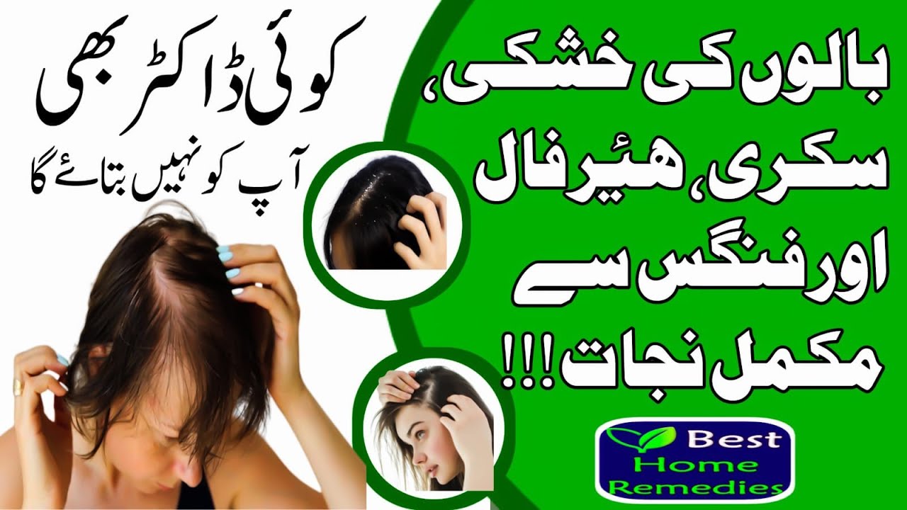 Balon Ki Khushki Sikri Fangas Ka Ilaj Hair Fall Treatment Hindi/Urdu