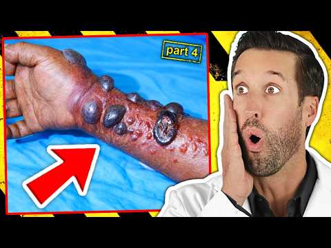 ER Doctor REACTS to World's Deadliest Diseases #4 thumbnail