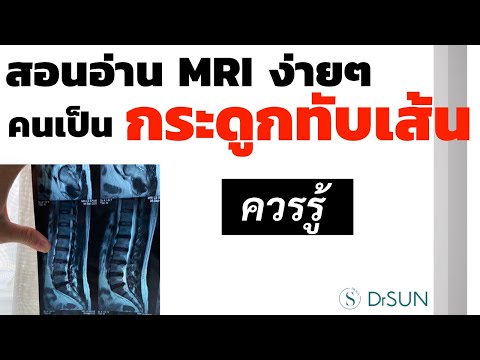 สอนอ่าน MRI ง่ายๆ ที่คนเป็น กระดูกทับเส้น ควรรู้/ เอ็มอาร์ไอ หมอนรองกระดูกทับเส้น/หมอซัน drsun