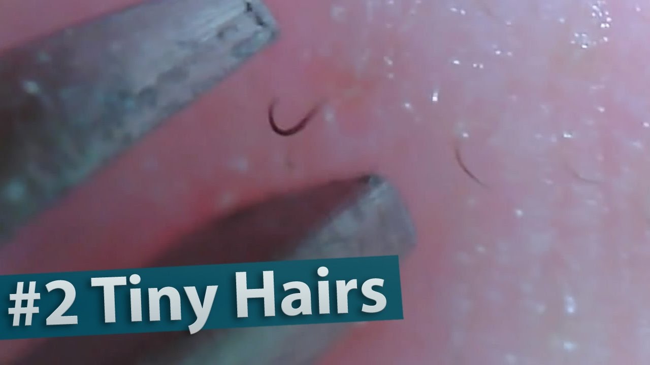2 Plucking Tiny Hairs On Nose Close Up Engineer Pt17 Youtube