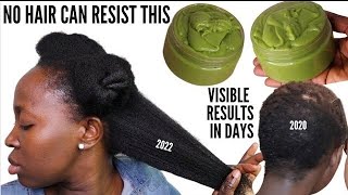 Unbelievable Only 2 Food  🔥 TO GROW BACK ALOPECIA.BALDNESS SLOW GROWTH 3 TIMES UNSTOPPABLE FASTER.