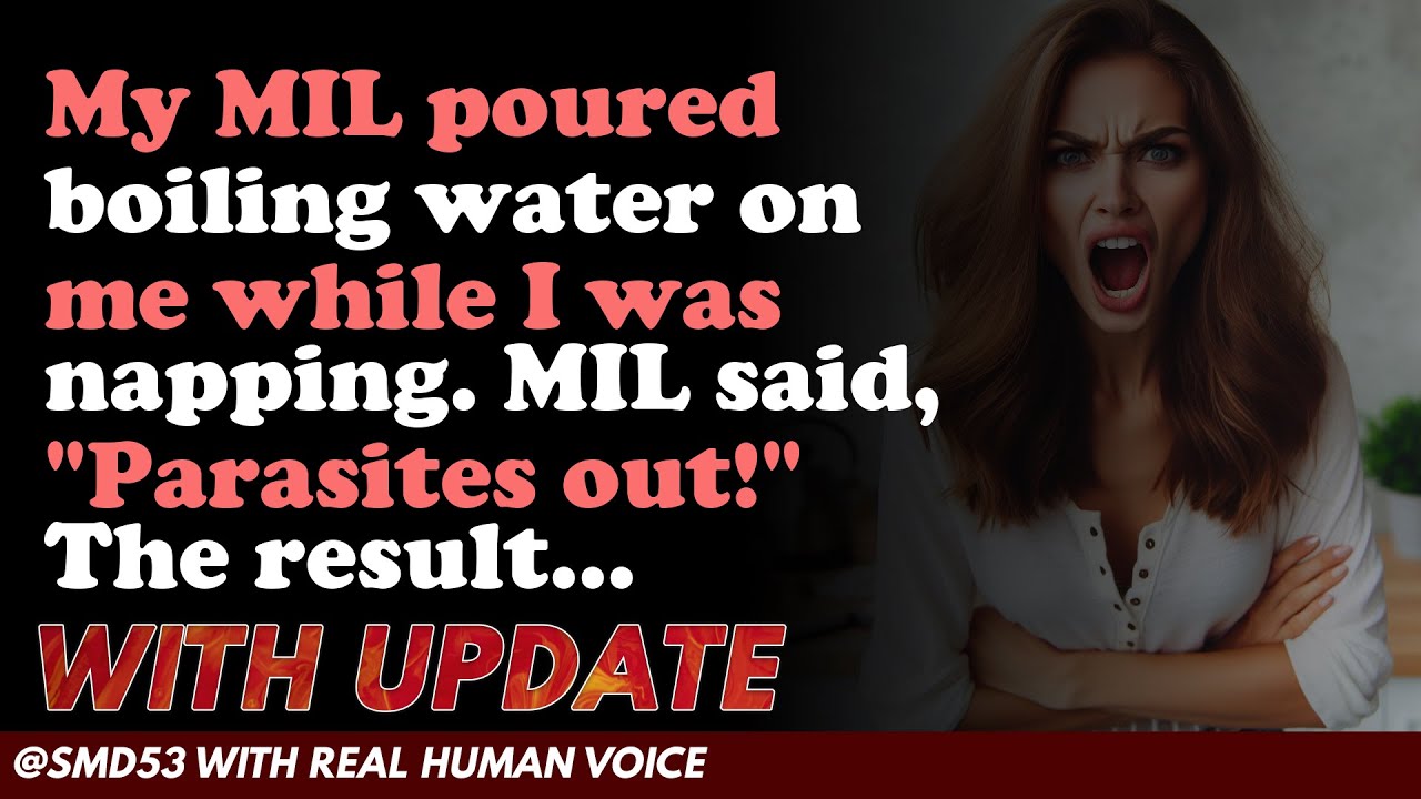 Reddit Stories | My MIL poured boiling water on me while I was napping. MIL said, "Parasites ...