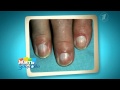 Диагноз по ногтям. Что ваши ногти говорят о вас