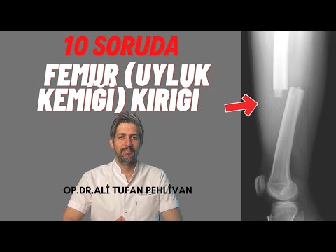 Femur (Uyluk Kemiği) Kırıkları