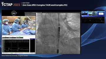 [TCTAP 2023] Live Case #12: Complex TAVR and Complex PCI