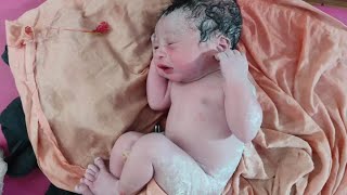 Beautiful Newborn baby Girl just after birth First Cry #viral