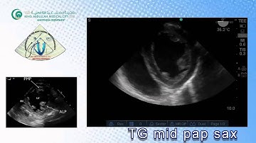 082 Basic View TEE KAMC