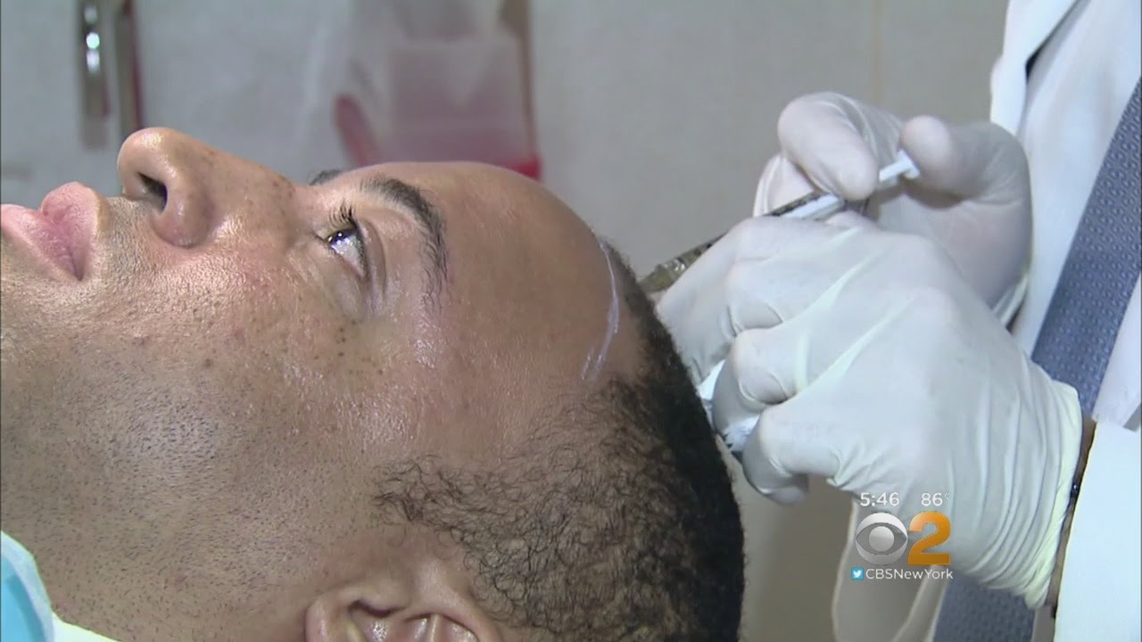 I Want My Hair Back Youtube