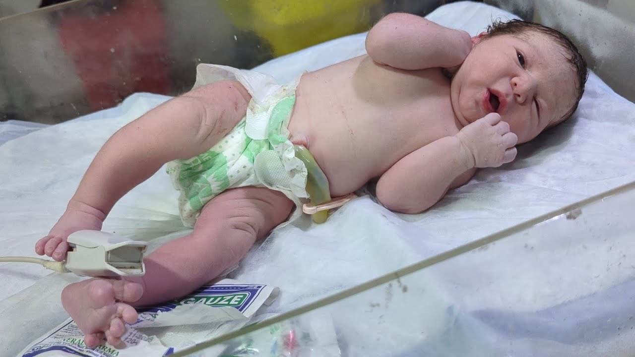 After Dilvery Newborn Head to Toe Assessment in NICU 👶🩺 | Complete Physical 💙 #assessment