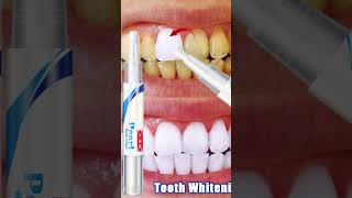 Magical teeth whitning at home | ytshorts youtubeshorts fashion shorts