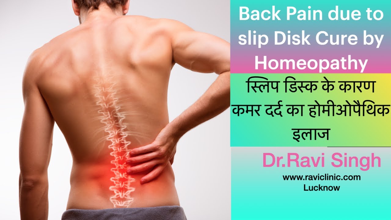 Back Pain Due to Slipped Disk Cured By Homeopathy Dr.Ravi Singh YouTube