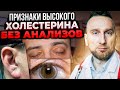 Как определить повышенный холестерин по глазам и ... Кардиолог @Доктор Утин