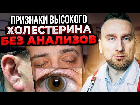 Видео: Как распознать признаки высокого холестерина: 12 шагов (с иллюстрациями)