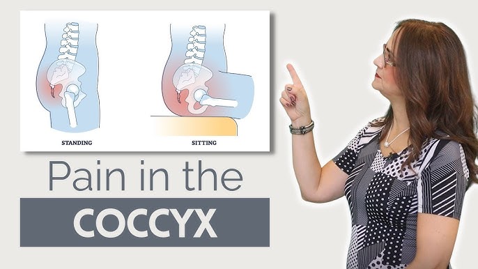 5 Ways To Relieve Tailbone Pain (Coccydynia) - Back Intelligence