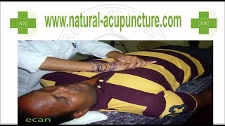 Acupuncture Courses India