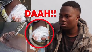 BALAA: Jamaa Aliyekata Vidole Zimbabwe Afunguka Maumivu Pesa Alizopata@PrinceofZimbabwe