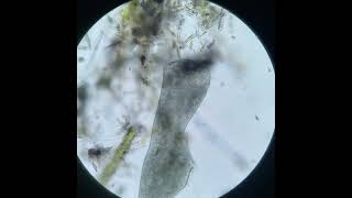 Stentor Binary Fission
