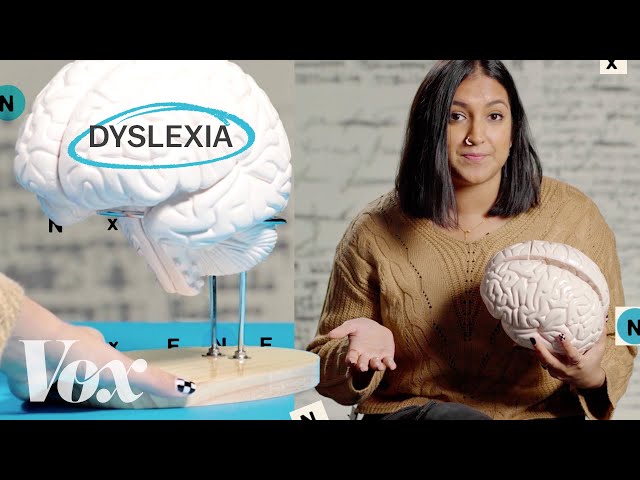 Why the dyslexic brain is misunderstood class=