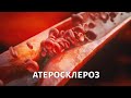 Доктор БОКЕРИЯ. Кому грозит атеросклероз?