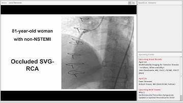 Emmanouil Brilakis - Update on Chronic Total Occlusion (CTO) Percutaneous Coronary Intervention