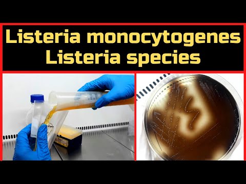 Video: Listeria monocytogenes è Gram positiva o negativa?