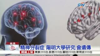 【中視新聞】精神分裂症 陽明大學研究:會遺傳 20150812