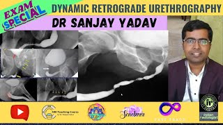 Dynamic Retrograde Urethrography | Dr Sanjay P | DRU #urethralstricture