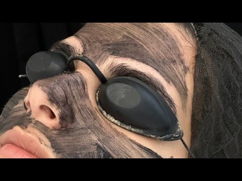 Virtual Las3r Unwanted Facial Hair Removal Powerful Subliminal