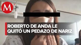 Ex candidato a alcalde en Veracruz le arrancó un pedazo de nariz a una mujer con los dientes