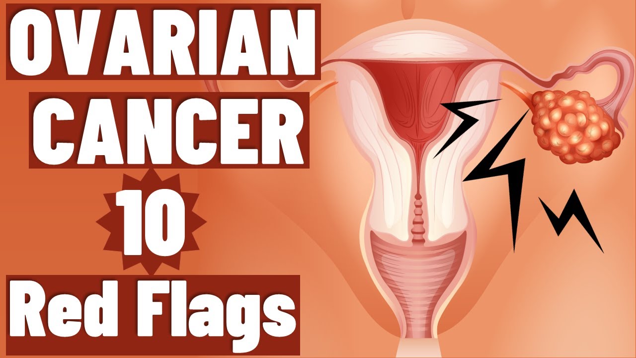 10 Everyday Symptoms of Ovarian Cancer Most Women Overlook