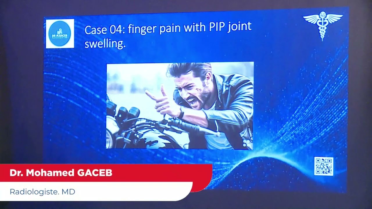 Dr Gaceb Radiologue MD