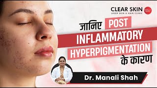 Post Inflammatory Hyperpigmentation के कारण | Post Inflammatory Hyperpigmentation-Clear Skin,Pune