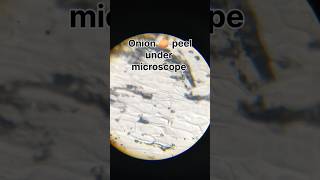 Onion peel 🧅 under microscope #shorts