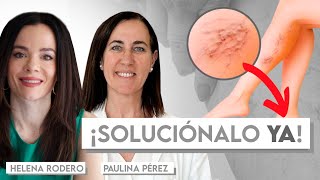 🦵 Así Mejoras tu Circulación, Varices e Insuficiencia Venosa 👩🏻‍⚕️ Charla con Dra. Paulina Pérez 🙌🏻